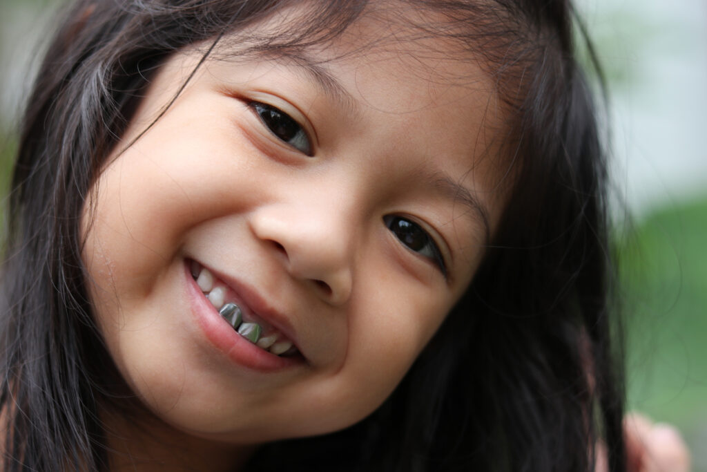 What Are The Different Types of Dental Crowns Available For Kids?